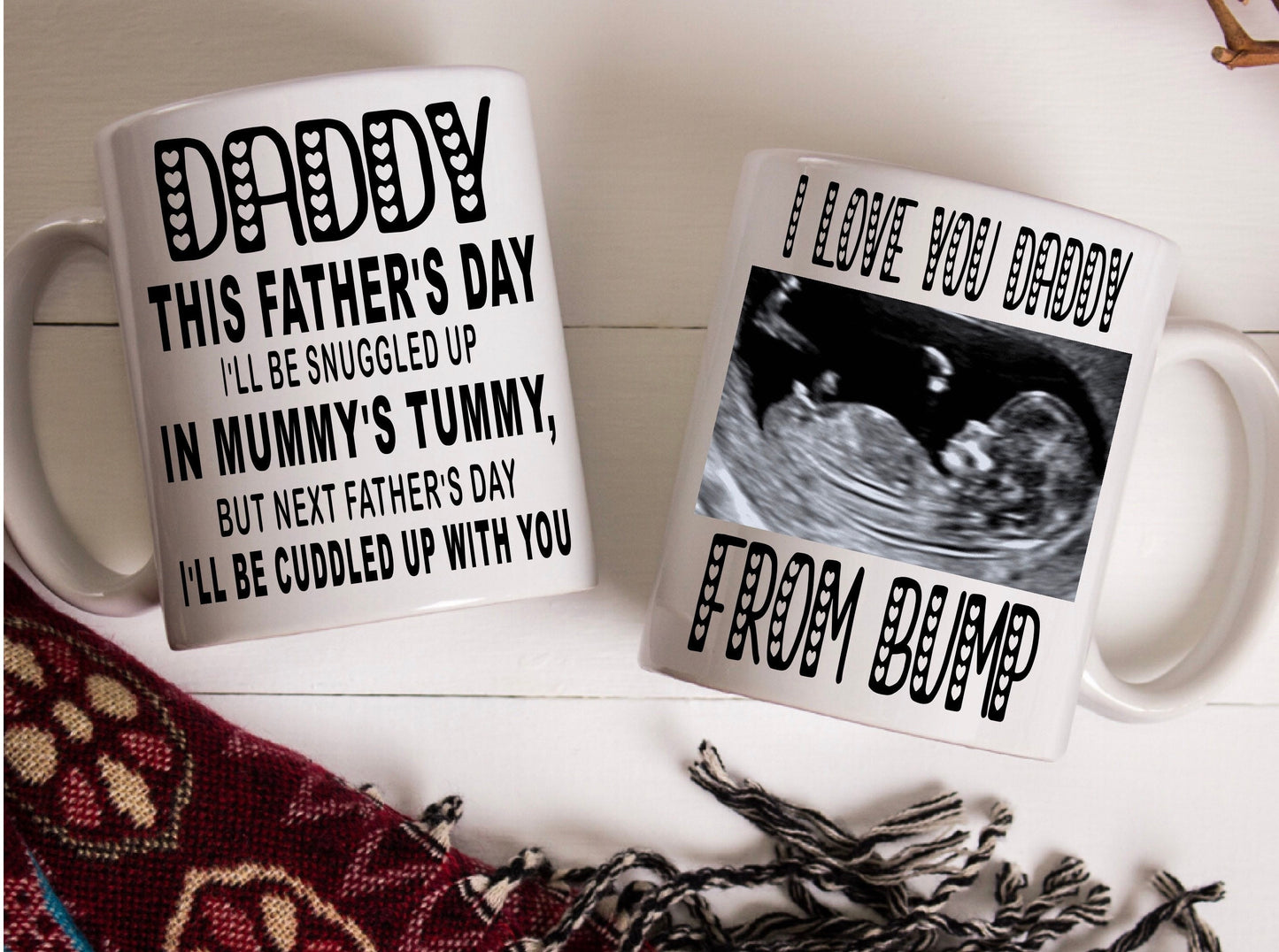 Daddy to be Father’s Day from bump present gift personalised with your scan photo mug cup keepsake 1st Father’s Day