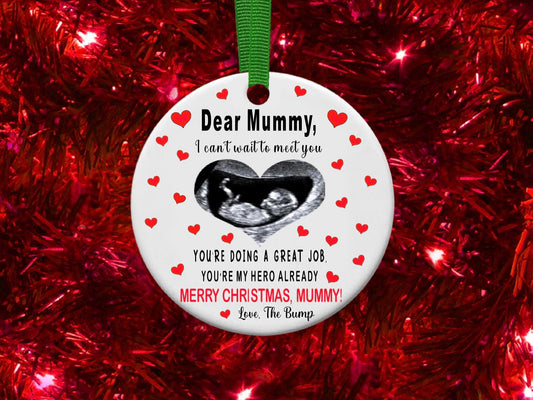 Mummy To Be Scan Personalised Christmas Bauble Funny Gift Present Keepsake Novelty Christmas Tree Xmas For Her